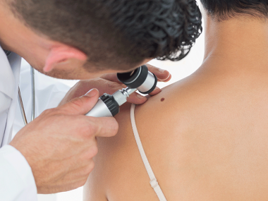 Médico analisa sinais de paciente para reconhecer o melanoma