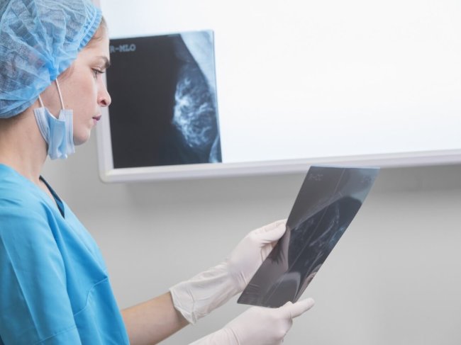 Oncologia mama