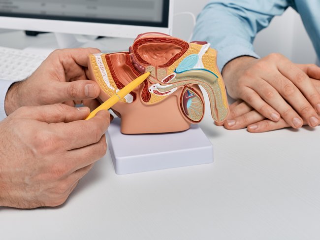 Médico a explicar as patologias da próstata ao doente com um protótipo de próstata