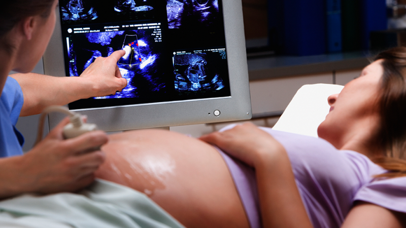 Diagnóstico de quisto do plexo coroideu