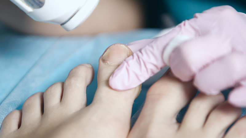 O que dizem as unhas sobre a saúde