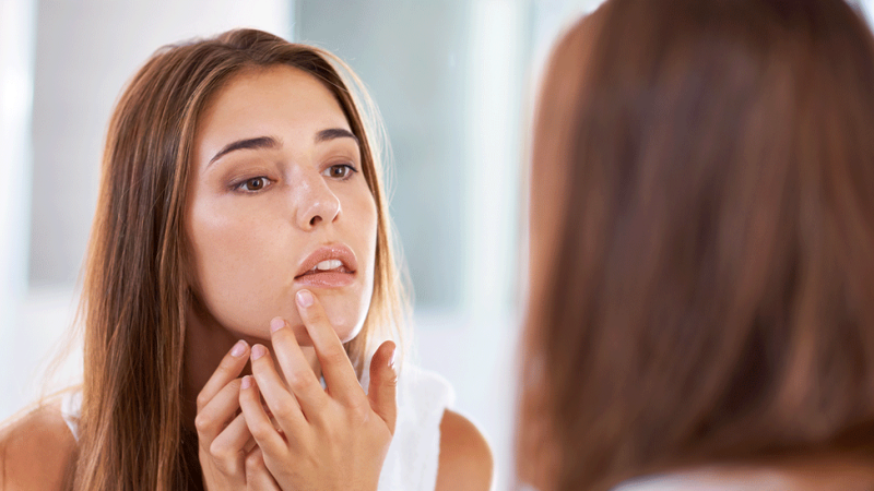 Mulher com acne na idade adulta avalia borbulha ao espelho