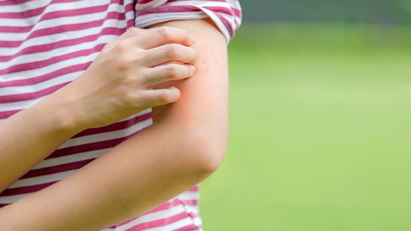 Indivíduo manifesta sintomas de angioedema