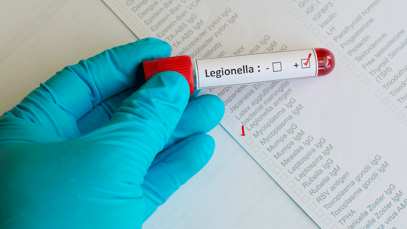 Médico analisa amostra de sangue para diagnóstico de Legionella