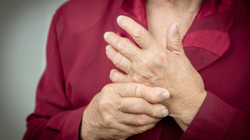 Mulher esfregas as mãos para atenuar dores da artrite reumatoide