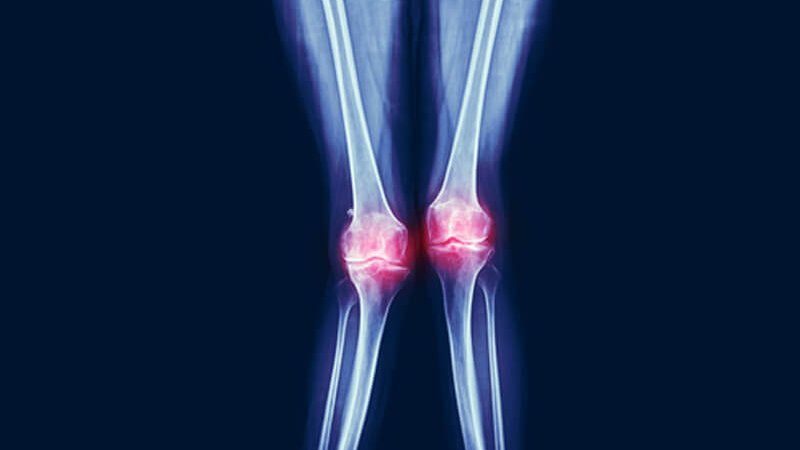 Curso Avançado Fixação Externa em Orto-Traumatologia