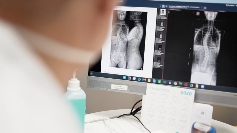 Médico analisa radiografia obtida através de equipamento EOS