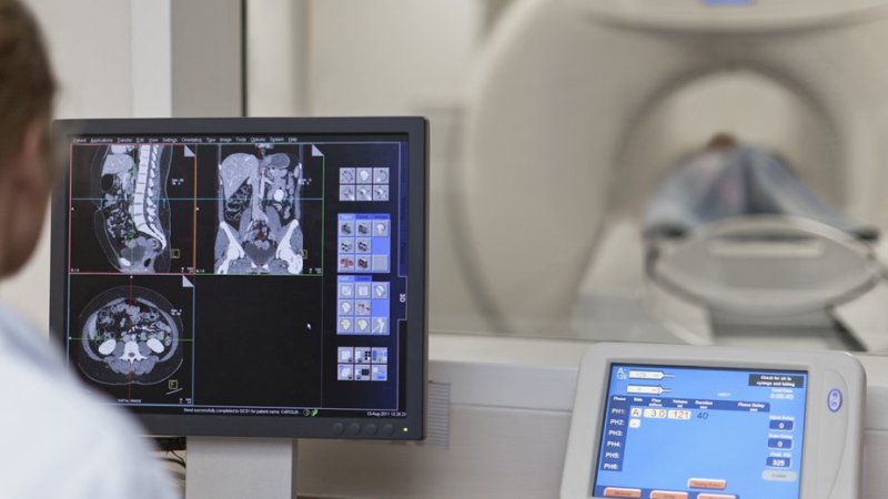 Médica faz ressonância magnética para diagnóstico de cancro