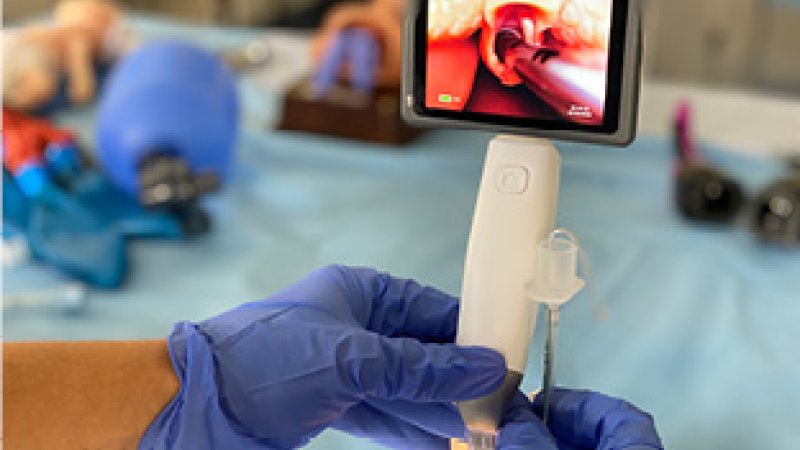 entubação neonatal