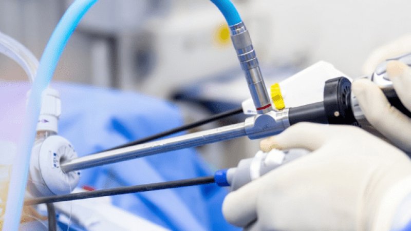 Procedimento cirúrgico com instrumentos de artroscopia inseridos através de pequenas incisões, manipulados por mãos com luvas em ambiente hospitalar.