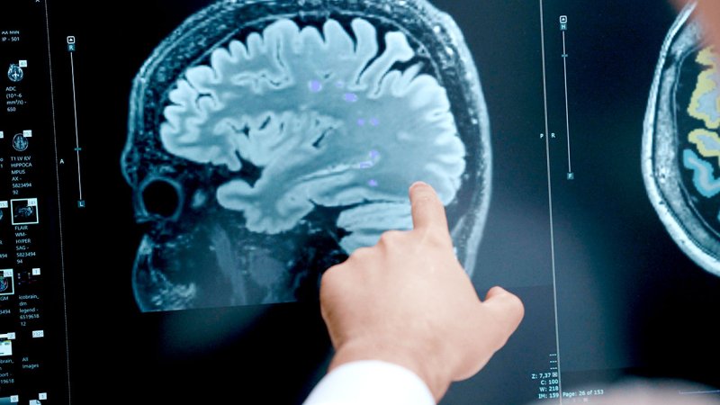 Médico analisa imagem realizada através de ressonância magnética.