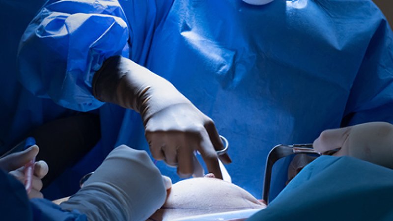 Equipa médica a realizar uma cirurgia, com profissionais de saúde equipados com bata, luvas e máscara e um paciente em ambiente hospitalar.