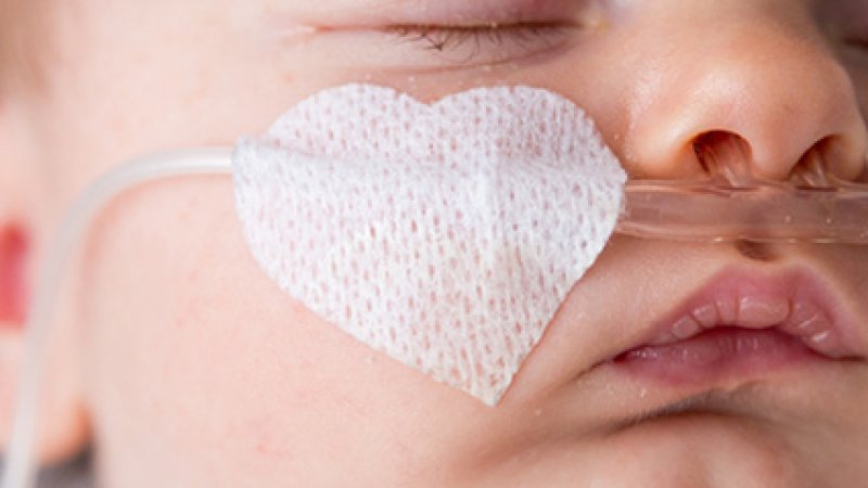 Close-up do rosto de um bebé a dormir e a usar uma uma canula nasal de oxigénio, fixada na bochecha com um adesivo branco em forma de coração.