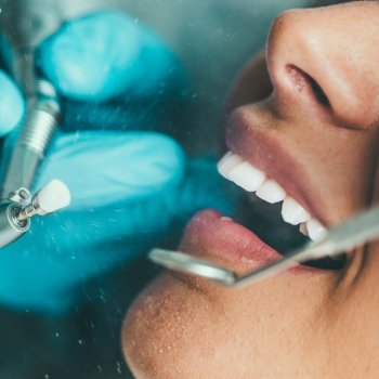 Estética dentária