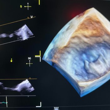 Exame de imagem de diagnóstico de Cardiologia