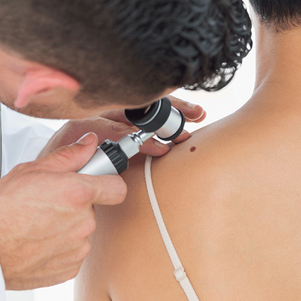 Médico analisa sinais de paciente para reconhecer o melanoma