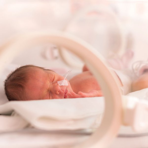bebé menina prematura na incubadora