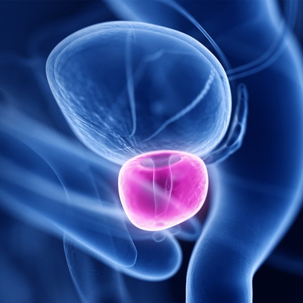 positiveprost_academia