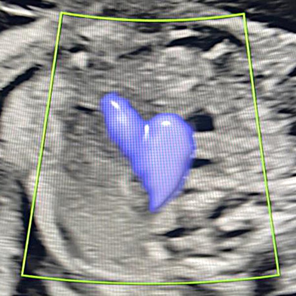 fetalpratico_academia