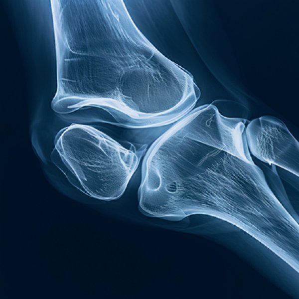 raio x joelho