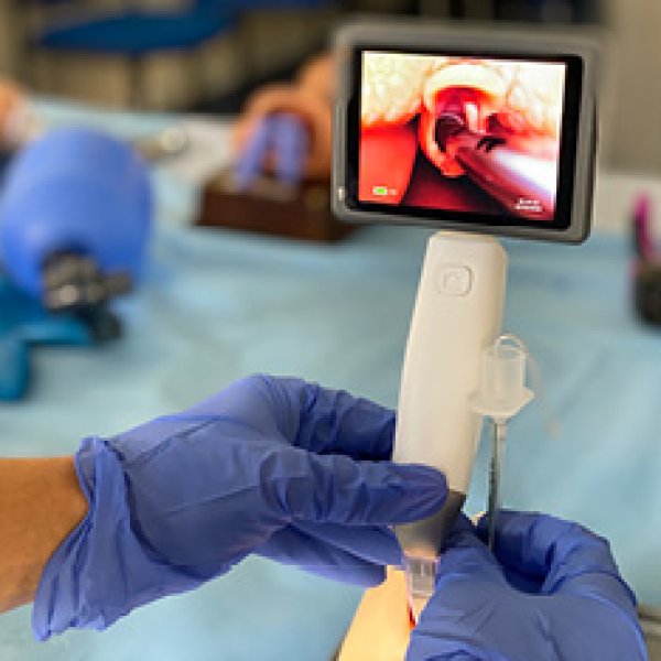 entubação neonatal