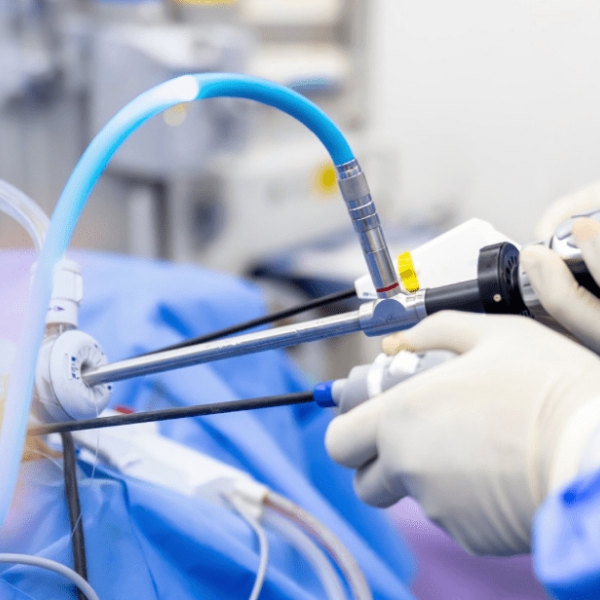 Procedimento cirúrgico com instrumentos de artroscopia inseridos através de pequenas incisões, manipulados por mãos com luvas em ambiente hospitalar.