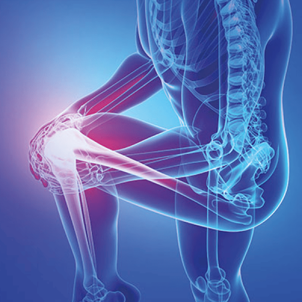 Ilustração do corpo humano com destaque na articulação de um joelho com dor ou inflamação