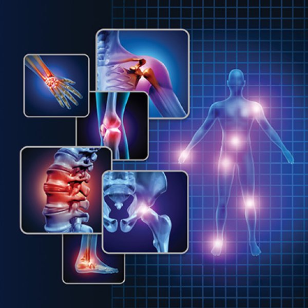 Corpo humano com várias áreas musculares identificadas.