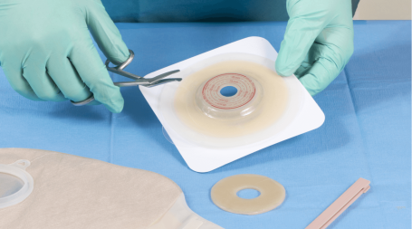 materiais para ostomia