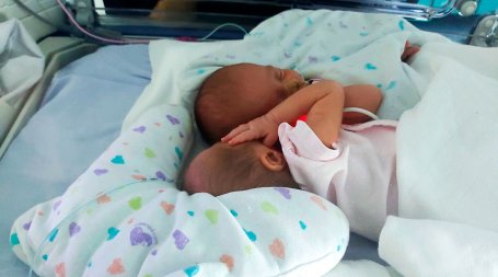 bébes gémeas prematuras