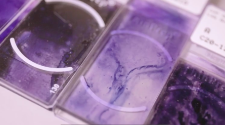 ensaios clinicos oncologia