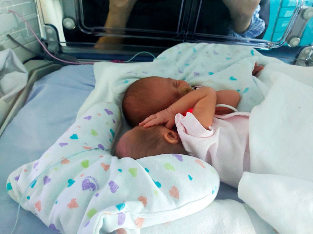 bébes gémeas prematuras