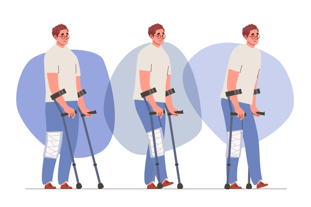 Ilustração de homem com canadianas a caminhar com carga parcial na perna lesionada