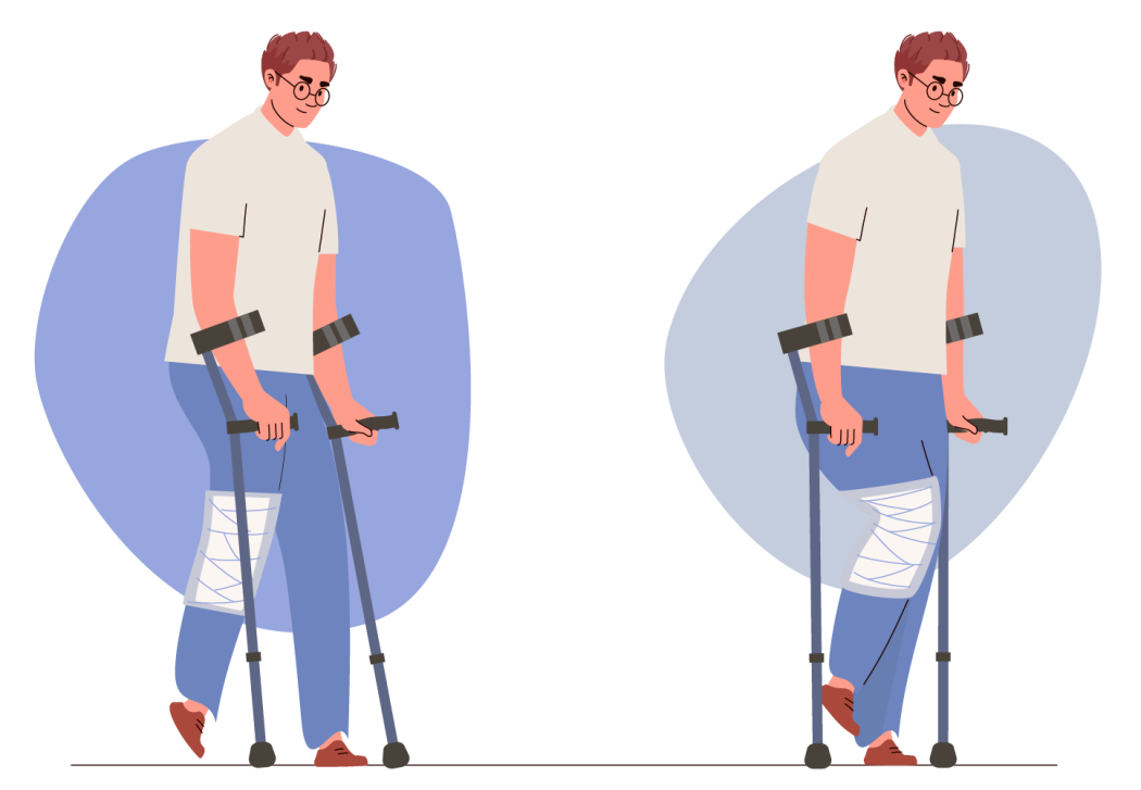 Ilustração de homem a caminhar sem carga na perna lesionada