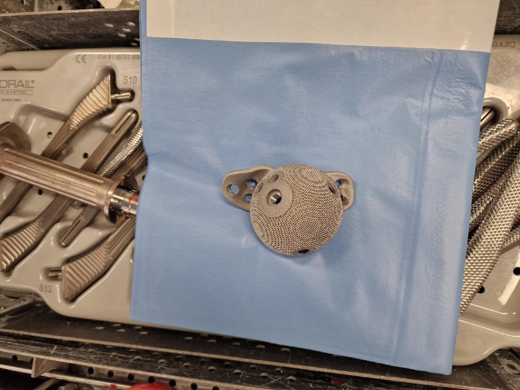 Prótese personalizada para cirurgia da anca