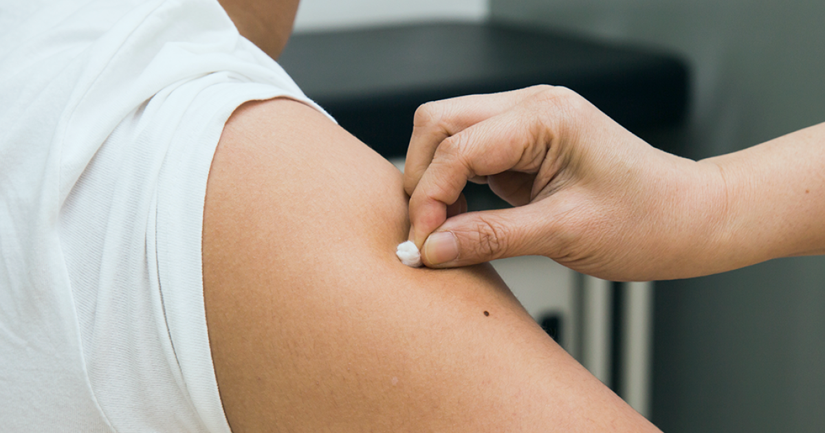 porque deve ter a vacina do tetano em dia cuf