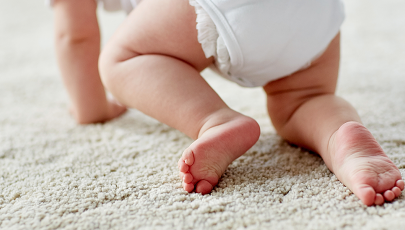 Bebé com displasia da anca a gatinhar