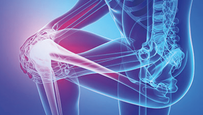 Ilustração do corpo humano com destaque na articulação de um joelho com dor ou inflamação