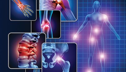 Corpo humano com várias áreas musculares identificadas.