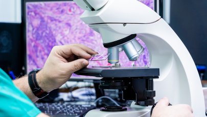 Observação de células de cancro ao microscópio no laboratório