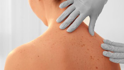 Médica a analisar os sinais na pele de uma senhora