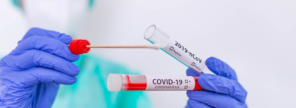 Testes à COVID-19
